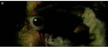 Joe's eye, stage 2